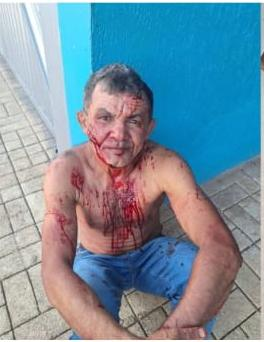 Homem mata companheira com golpes de faca em Tucumã